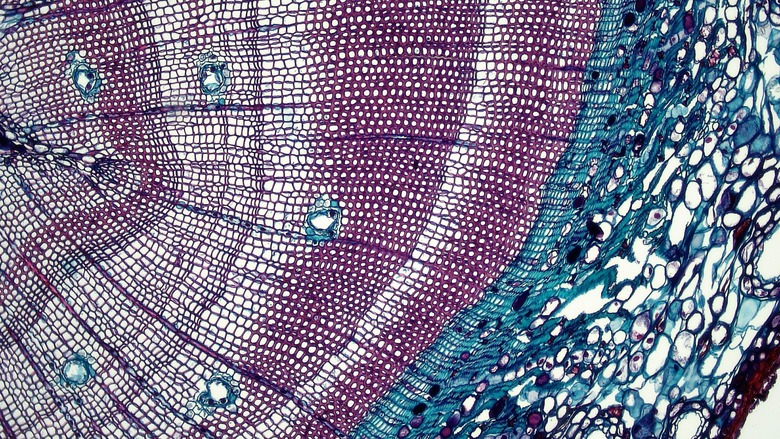 A microscopic image of a pinus stem